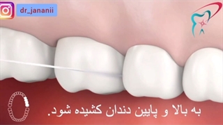 روش صحیح استفاده از نخ دندان