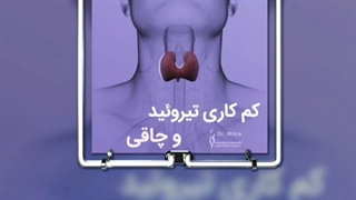 کم کاری تیروئید و چاقی