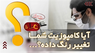 تغییر رنگ کامپوزیت ونیر دندان | عارف کلینیک