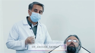 لیزر موهای زائد در آقایان