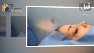 فیلم جراحی زیبایی بینی در اتاق عمل