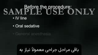 جراحی سرطان سینه | آشنایی با روش‌های جراحی سرطان سینه