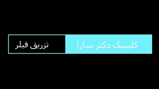 تزریق فیلر