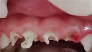 دندانپزشکی کودکان تحت بیهوشی| دکتر ماریتا شکاریان