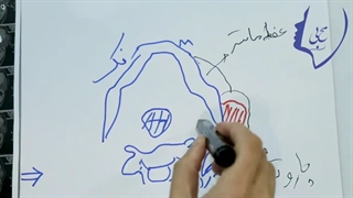 فیلم جراحی تومور پاروتید