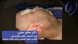 فیلم جراحی تومور بدخیم صورت