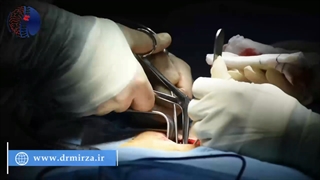 پارگی دیسک در خانمی جوان با وزن بالا