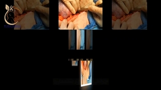 تومورتخمدان