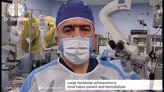 عمل جراحی تومور سی پی انگل در بیمار مبتلا به نارسایی کلیه و دیالیز