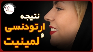 رضایت خانم احمدوند عزیز از درمان ارتودنسی و لمینت در عارف کلینیک