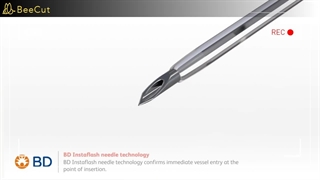 نحوه استفاده از آنژیوکت در تجهیزات پزشکی خسروی دانش