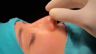 فیلم جراحی بینی| دکتر علیرضا تولیت