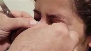 آموزش چسب زدن بینی بعد از جراحی، گرگان ، گنبد ۰۹۳۳۶۰۹۳۰۰۰