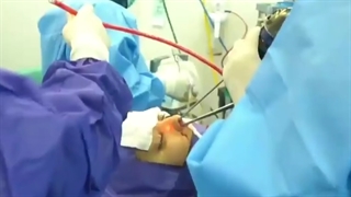 جراحی همزمان زیبایی بینی، پولیپ و تخلیه سینوس در خانم جوان با تنگی نفس