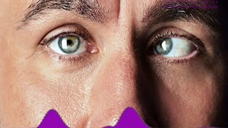 دوبینی و انحراف چشم درمان دارد؟