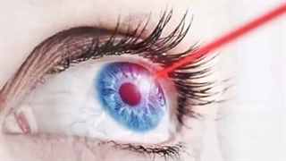 سن مناسب لازک چشم