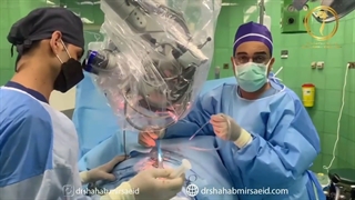 تومور بسیار بزرگ مخچه و مغز