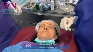 فیلم واقعی لیفت ابرو