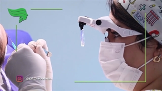 کاشت ابرو با روش طبیعی