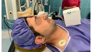 جراحی بینی با اسکنر سه بعدی