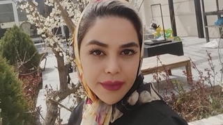 پنج ماه بعد از جراحی زیبایی بینی