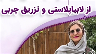 ضایتمندی مراجعه کننده عزیزمون از لابیاپلاستی و تزریق چربی