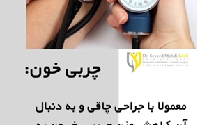 مزایای عمل جراحی چاقی