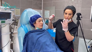 فیلم تزریق چربی زیر چشم