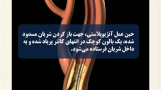 بالون قلب چیست؟