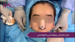 جراحی همزمان بینی و گوش