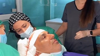 فیلم کاشت مو