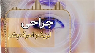 جراحی لیزیک و انحراف چشم