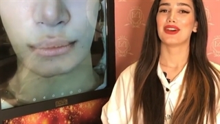 رضایت مراجعه کننده برای کاشت ابرو بدون عوارض