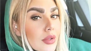 تصاویر کاشت ابرو