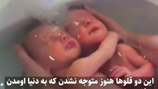 فیلم جالب بارداری دوقلو