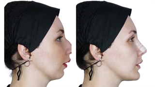 ارتودنسی و جراحی فک | دکتر داودیان