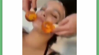 مزایا ، عوارض و هزینه فیشیال پوست صورت