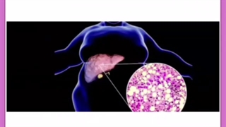 تاثیرات پاکسازی کبد در کاهش وزن + پیشنهاد بهترین مکمل دارویی و نکات مهم