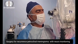 عمل جراحی عود مننژیوم پتروکلیوال