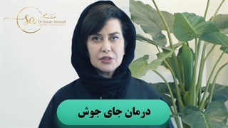 درمان سریع جای جوش