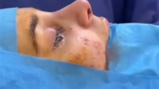 لایو اتاق عمل جراحی بینی