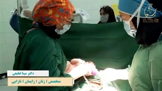 زایمان سزارین