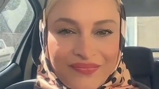 مریم کاویانی لیفت صورت