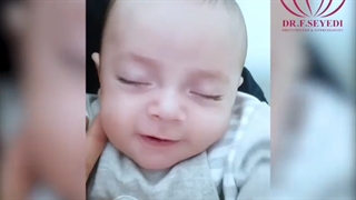 زایمان سزارین آقا آرتام کوچولو
