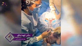 زایمان سزارین در تهران