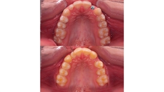 ارتودنسی و ایمپلنت | دکتر داودیان