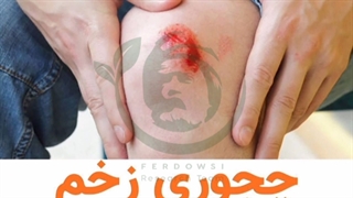 چجوری زخم تبدیل به ویتیلیگو میشه؟ پیسی برص