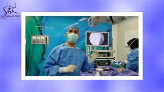 جراحی همزمان اندوسکوپی سینوس و پاکسازی آنها از پولیپ با جراحی زیبایی بینی در بیمار با مشکلات شدید تنفسی