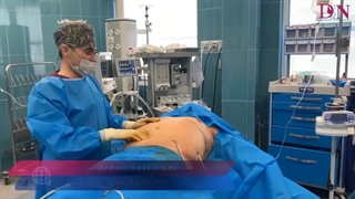لیپوماتیک شکم آقای 55 ساله