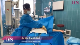 جراحی لیپوماتیک ۳۶۰ درجه